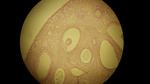 MISSING THUMBNAIL